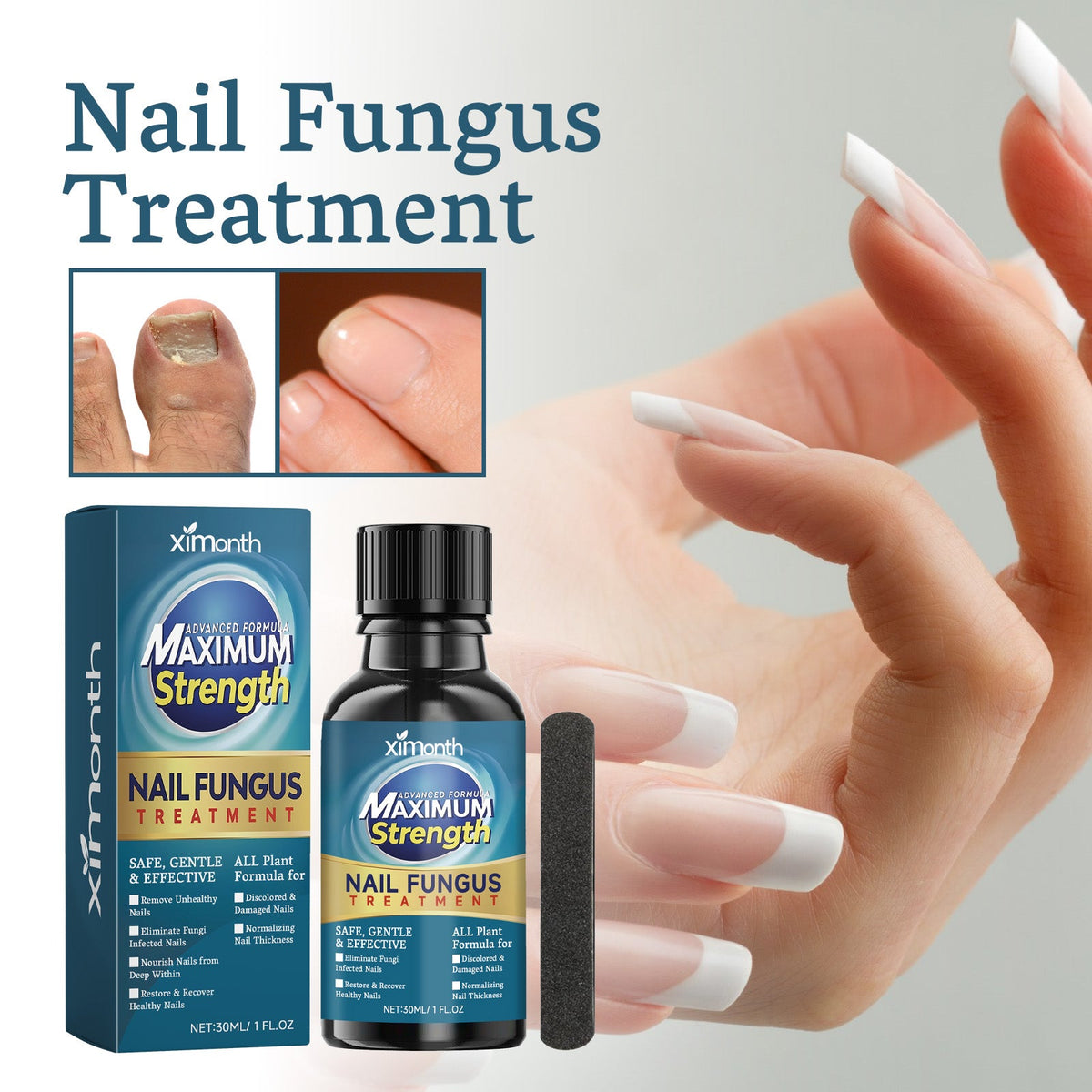 Nail Embedding Thickened Bright Nail Grey Nail Soft Nail Hand Foot Nail Care Liquid Nail Care Liquid 30 Bottles-1 Scraper Box Tri Light Beauty