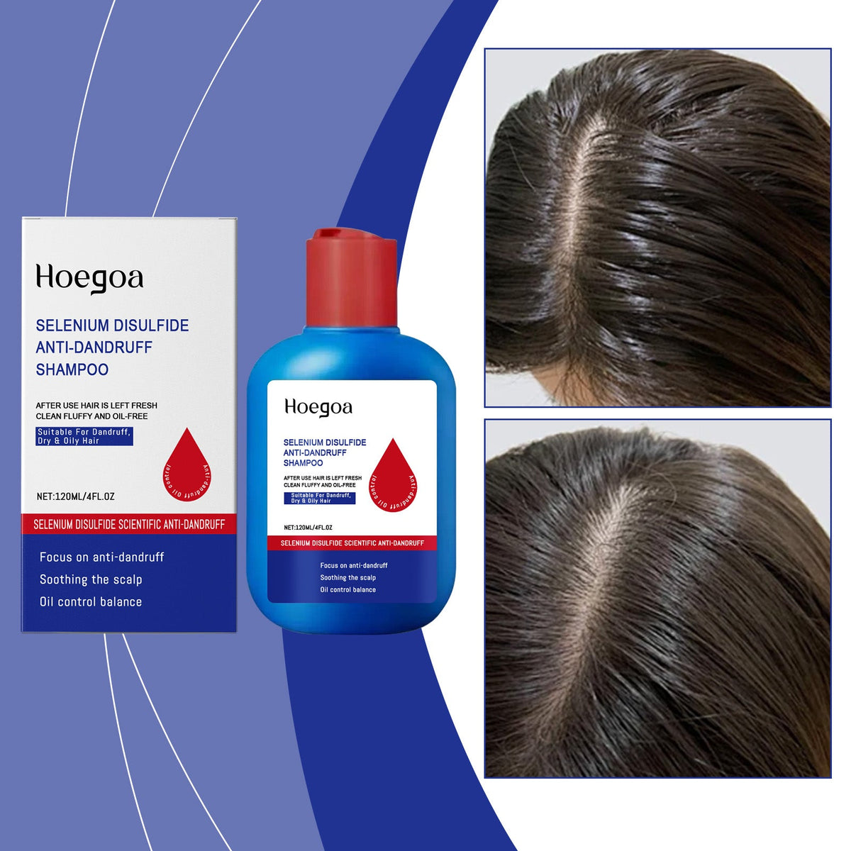 Selenium Disulfide Control Oil Shampoo 120ml Box Tri Light Beauty