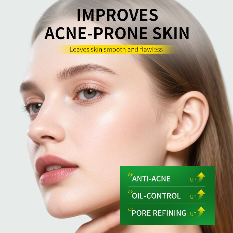 HUNMUI Salicylic Acid Acne Cream 30g Tri Light Beauty