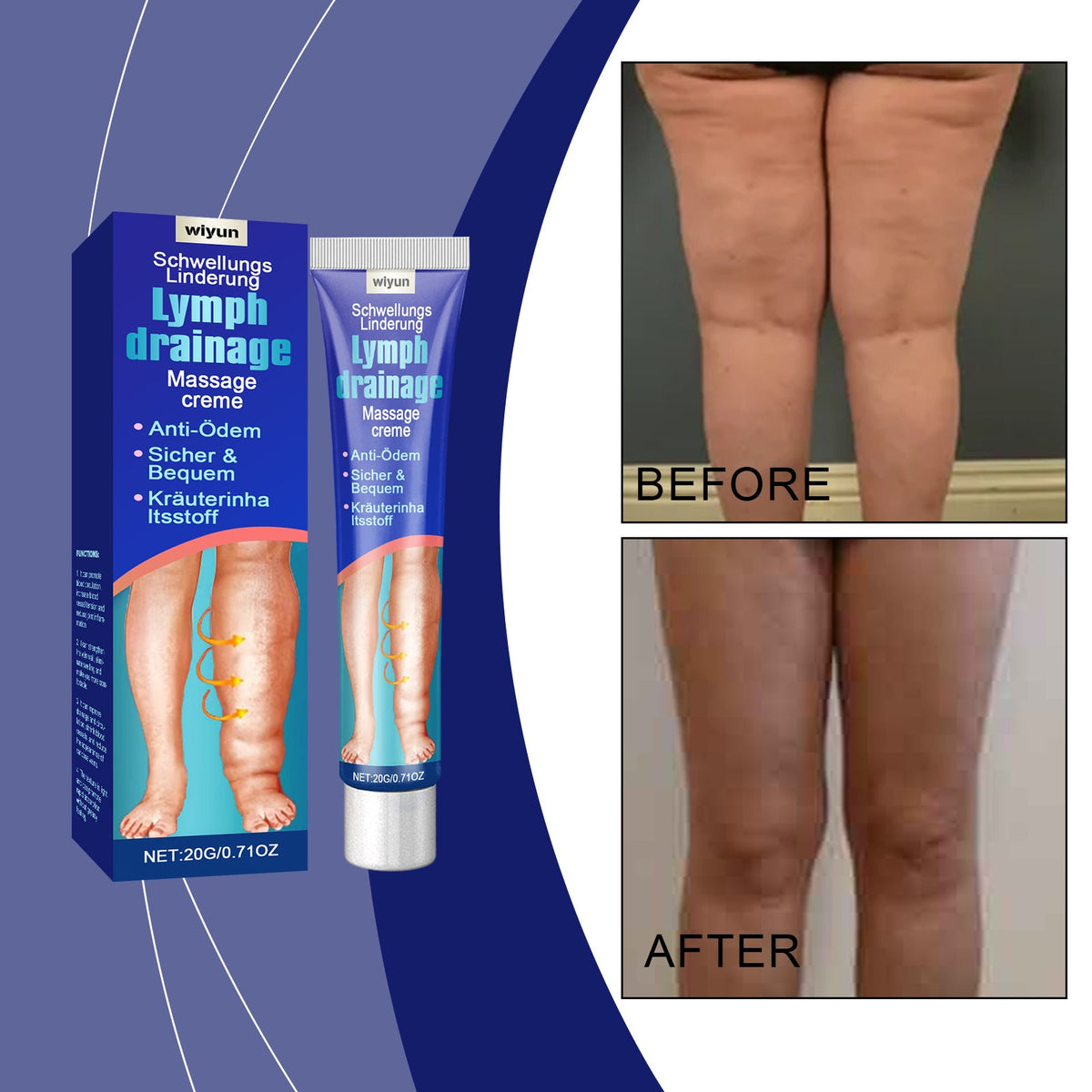 Relieve Leg Discomfort, Repair Daily Body Care, Moisturize The Skin, Massage Cream, Relieve Leg Swelling, Care Cream 20g 1 Box Tri Light Beauty