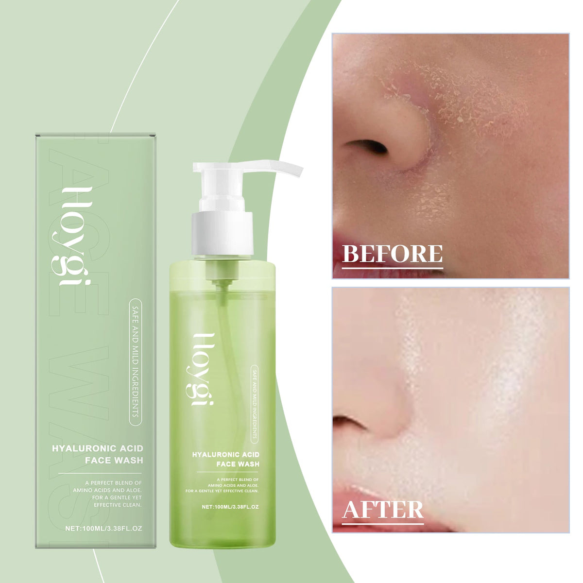 Cleansing Pores, Cleansing Facial Skin, Refreshing, Moisturizing, Smooth, Hyaluronic Acid Mild Cleansing Gel 1 0 0ml 1 Box Tri Light Beauty