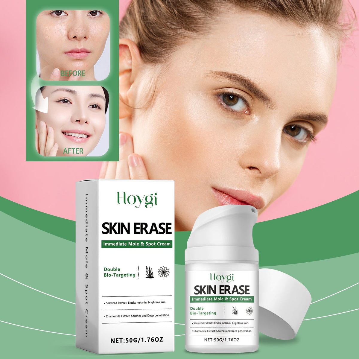 Brightening And Spot Whitening Moisturizing Cream Tri Light Beauty