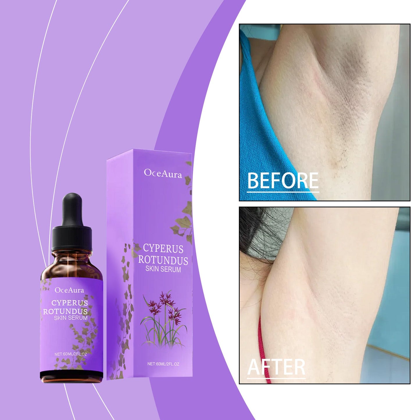 Post-Hair Removal Repair Serum Tri Light Beauty