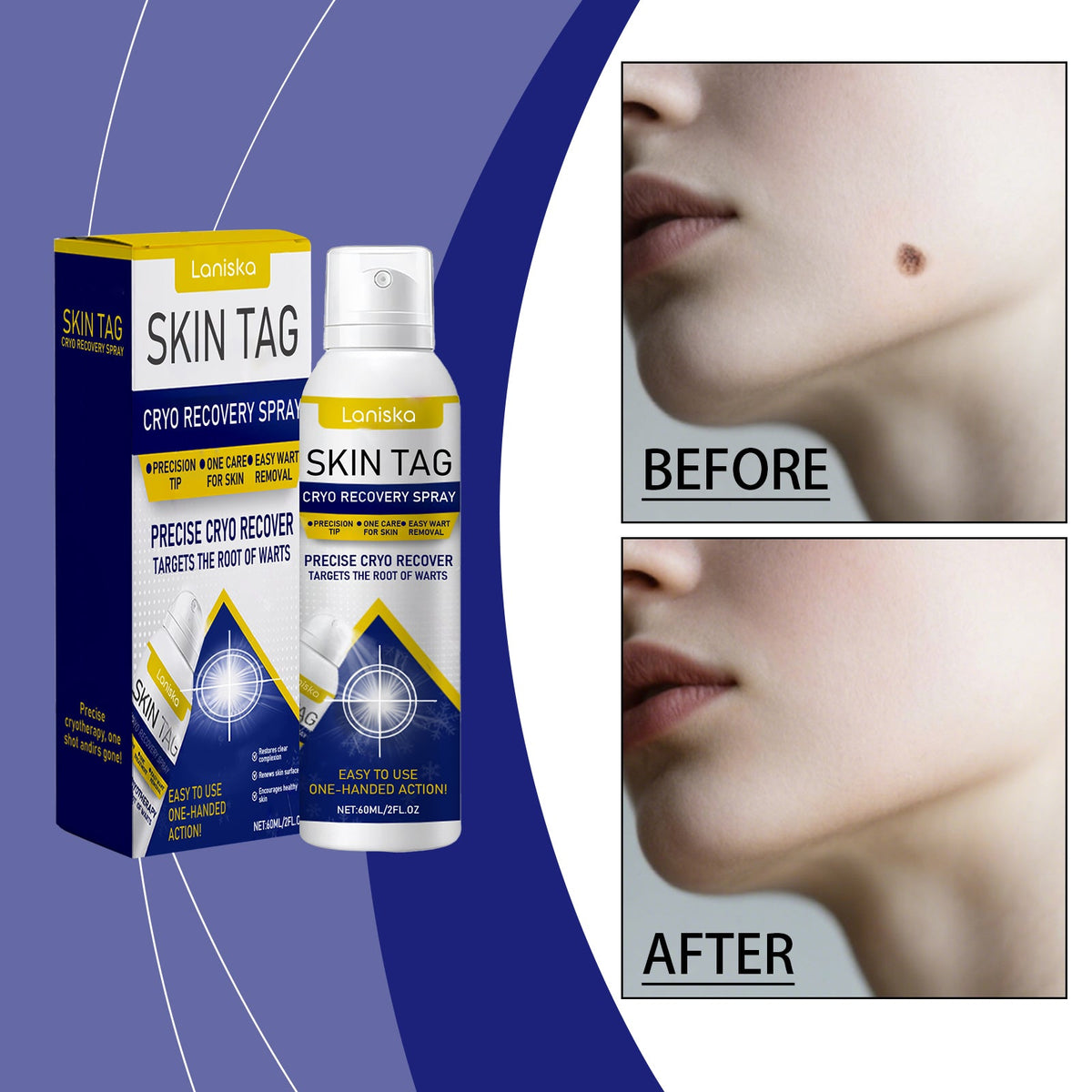 Skin Purifying And Rejuvenating Spray 60ml Box Tri Light Beauty
