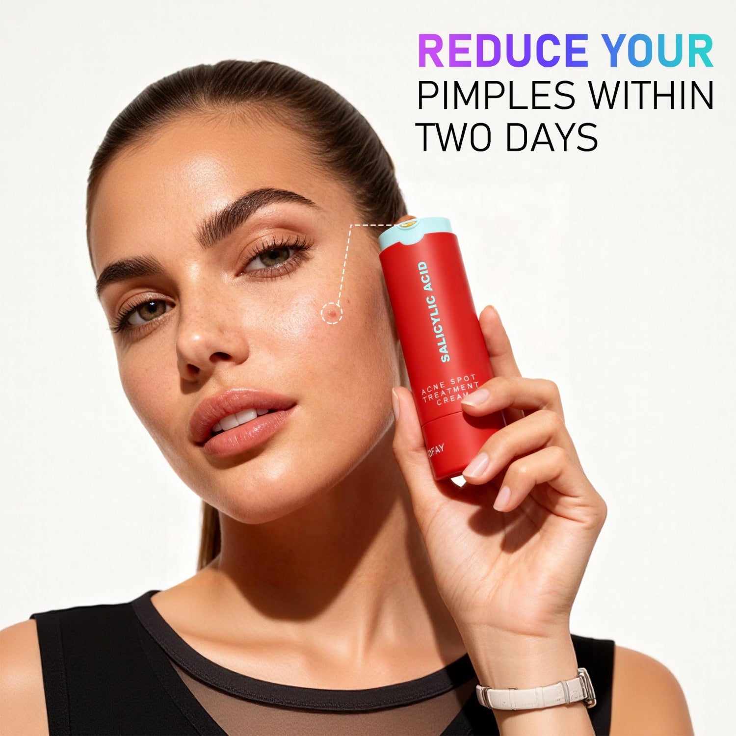 C-S003 Acne Removing Lotion LadyShow.Store