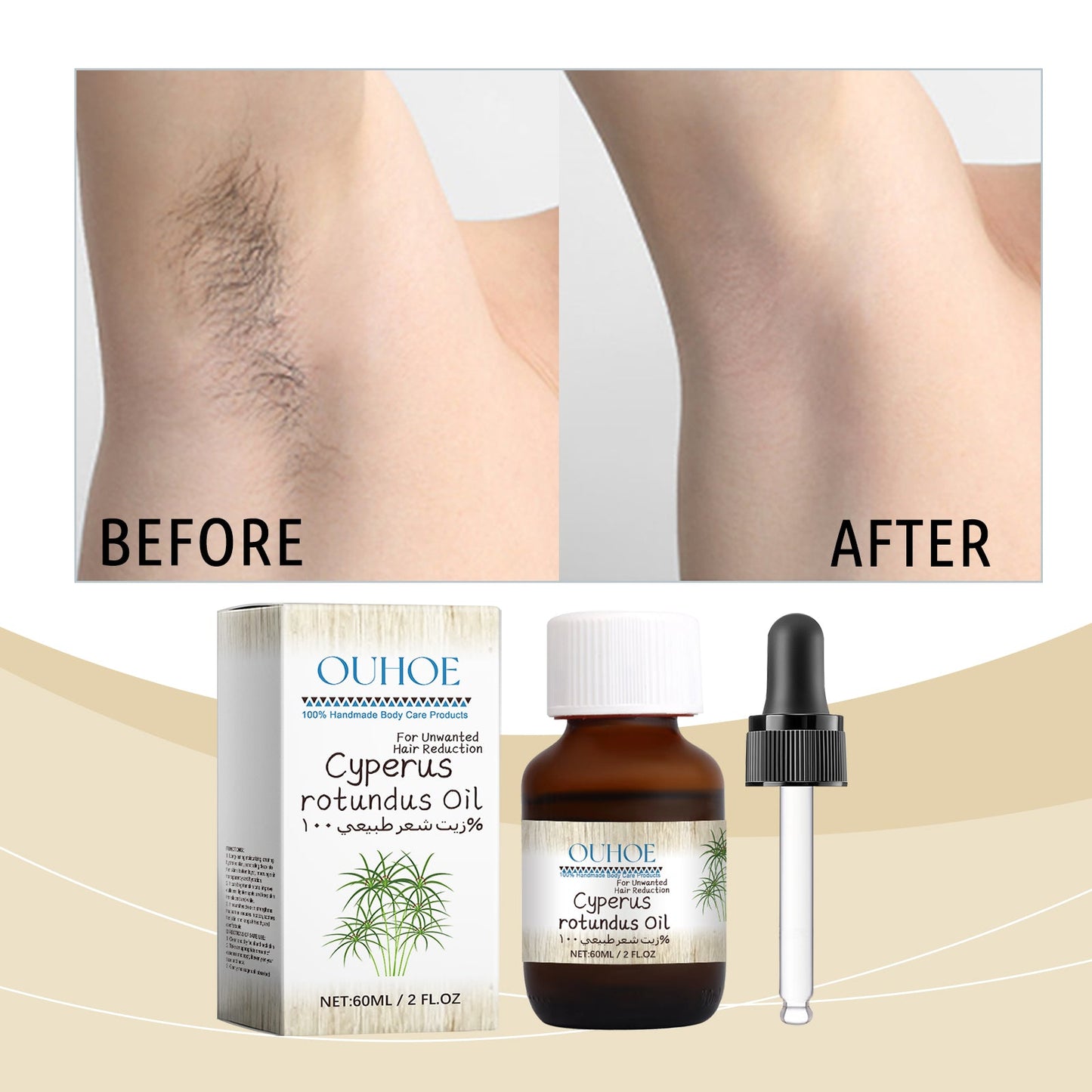 Cyperus Hair Removal Care Oil Tri Light Beauty