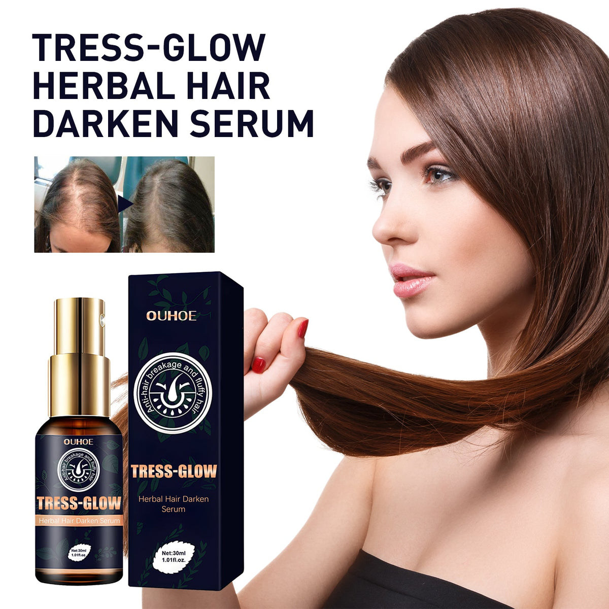 Gentle Moisturizing Scalp, Gentle Massage, Care For Beard, Gloss Care, E Ssence, Herbal Strong Hair Root E Ssence Oil, 30ml, 1 Box Tri Light Beauty