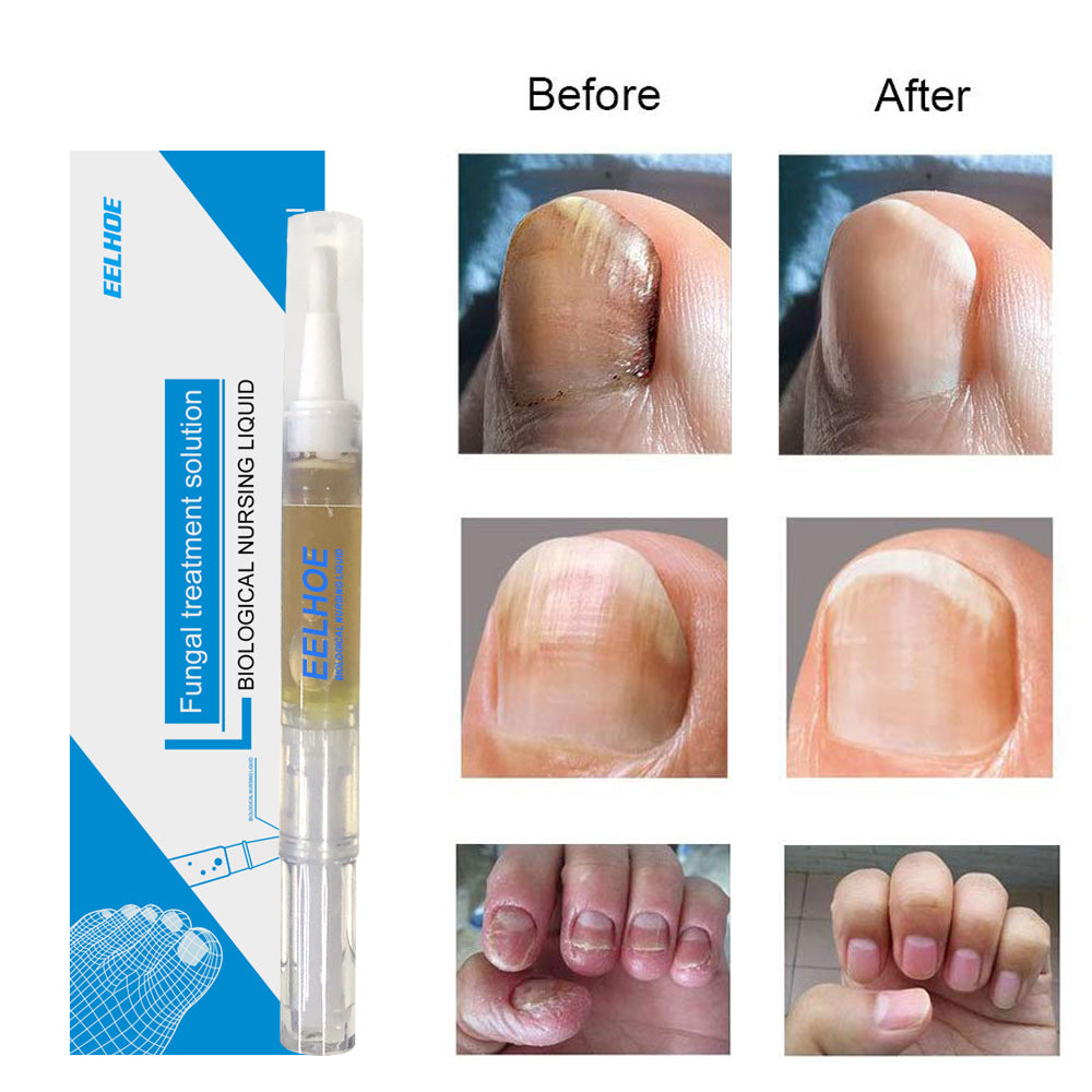 Nail Repair 3ml Box Tri Light Beauty
