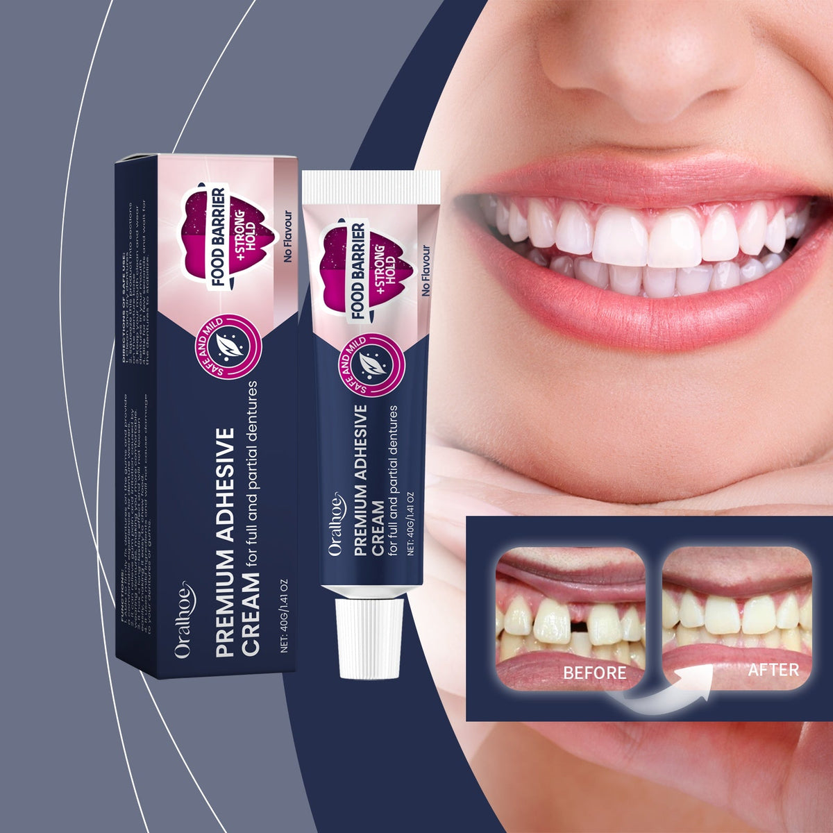 Dental Fixing Adhesive 40g-box Tri Light Beauty