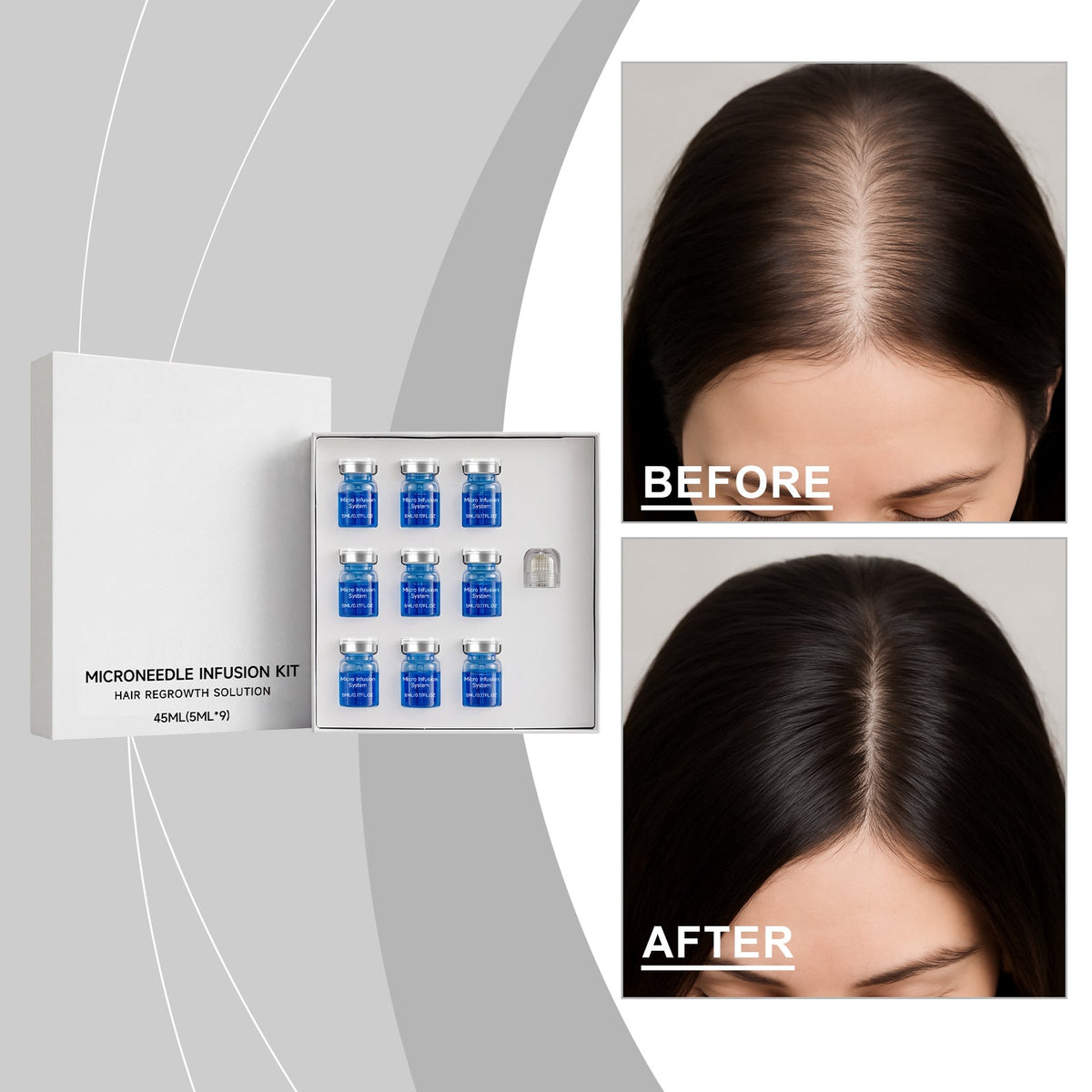 Scalp Serum Microneedle Kit 45ml-box Tri Light Beauty