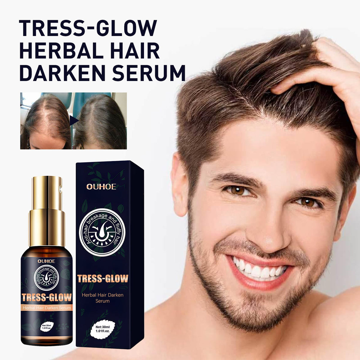 Gentle Moisturizing Scalp, Gentle Massage, Care For Beard, Gloss Care, E Ssence, Herbal Strong Hair Root E Ssence Oil, 30ml, 1 Box Tri Light Beauty