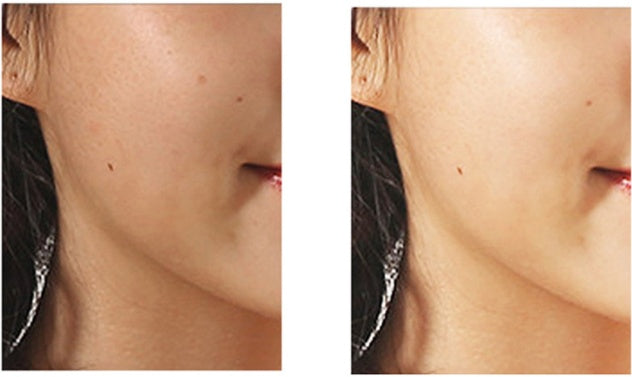 Mini Face Rotating Pore Cleansing Brush LadyShow.Store