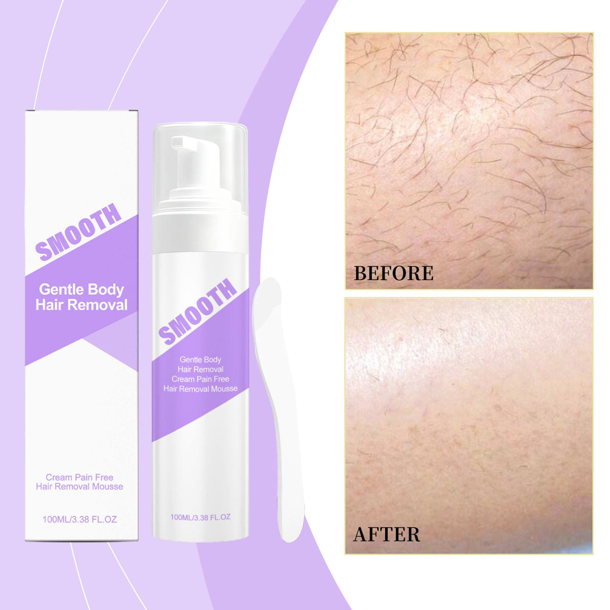 Gentle Soothing Hair Removal Mousse 1 0 0ml Box Tri Light Beauty