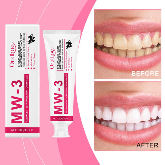 Whitening And Stain-removing Toothpaste Tri Light Beauty