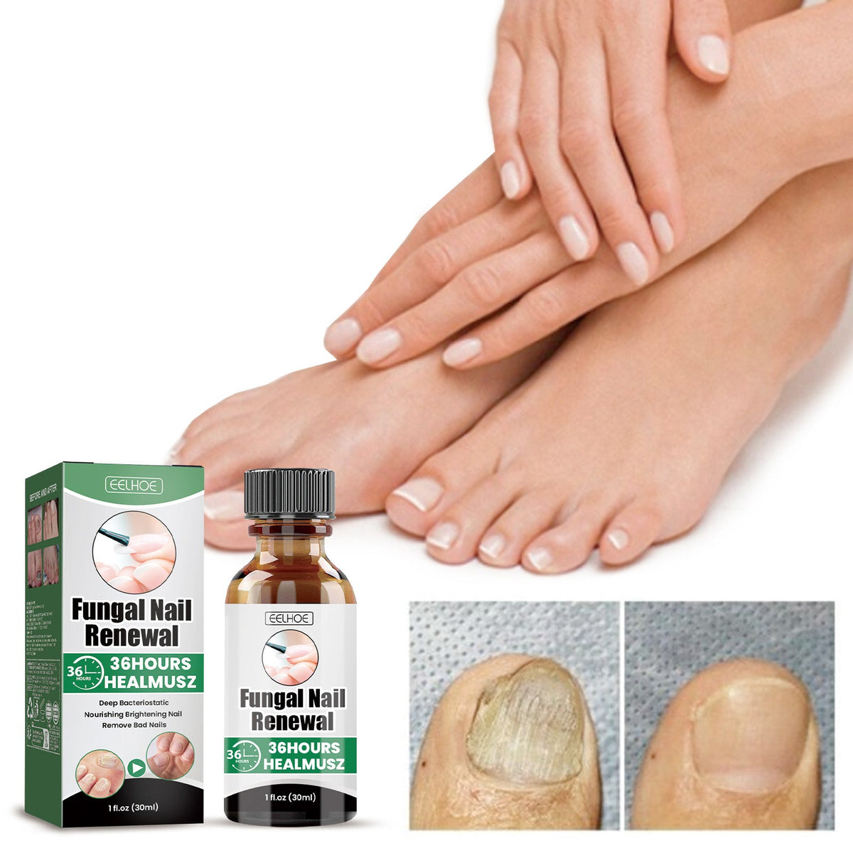 Bright Armor Soft Nail Moisturizing Armor Hand And Foot Nail Care Liquid Nail Strengthening Nourishing Liquid 30ml 1 Box Tri Light Beauty