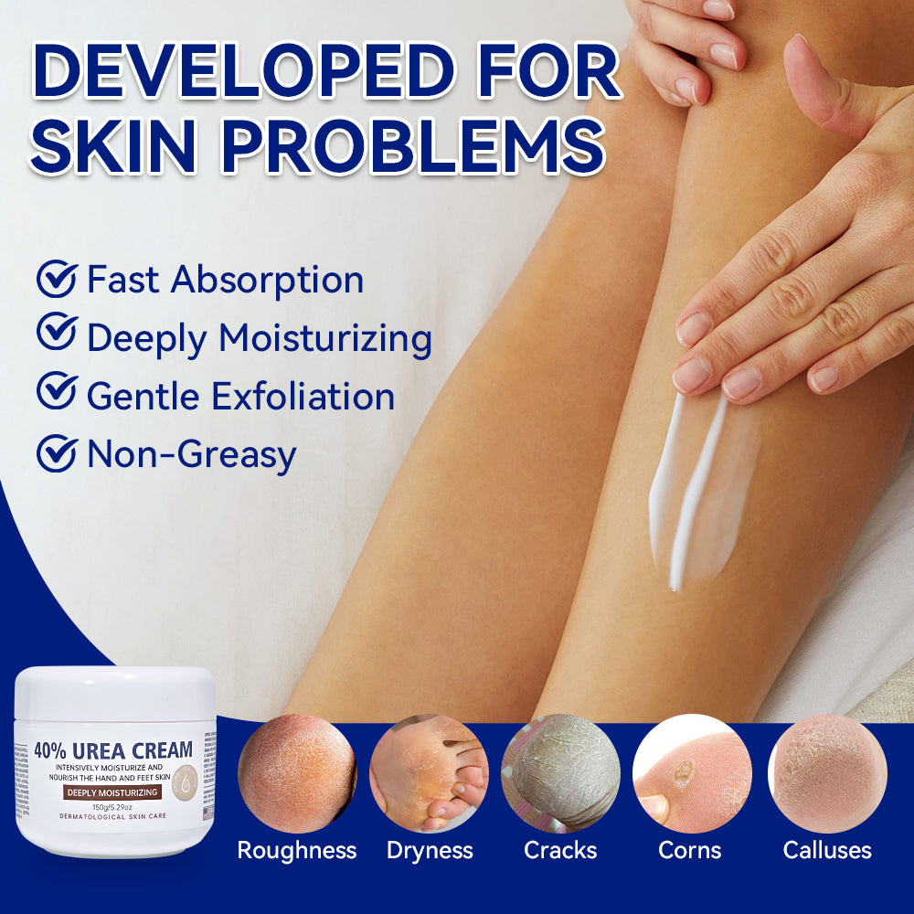 ETEB Urea Cream Moisturizing Vitamin E Cream Body Lotion Hand And Foot Care For Dry Hands And Feet Tri Light Beauty