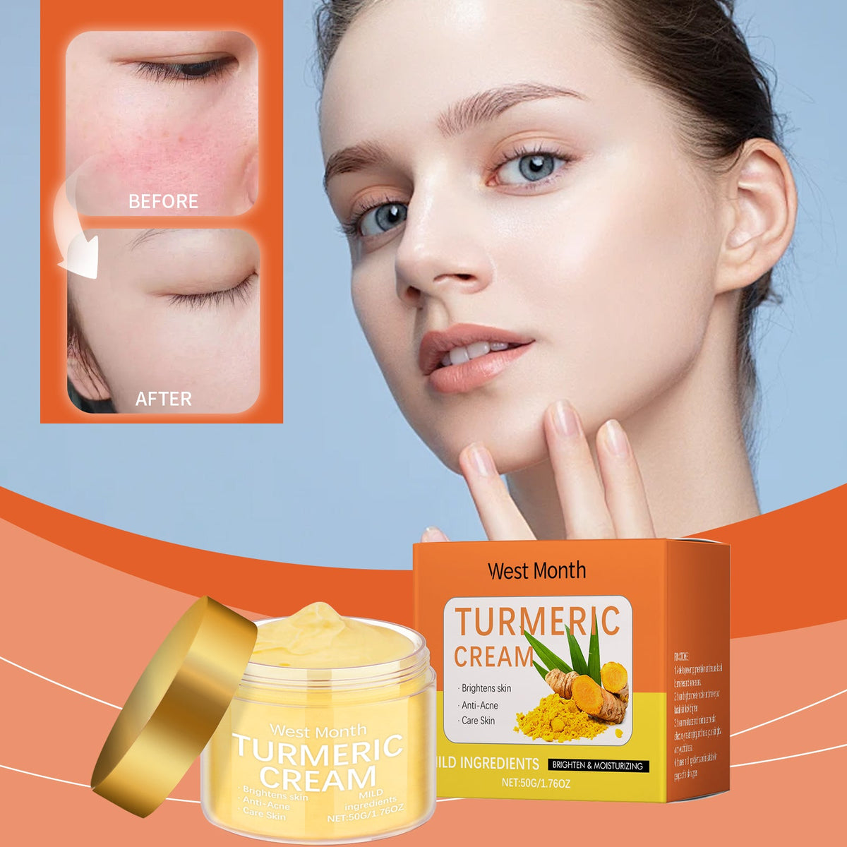 Turmeric Moisturizing Cream Brightens Skin, Fights Acne, Nourishes And Hydrates, Suitable For All Skin Types. Tri Light Beauty