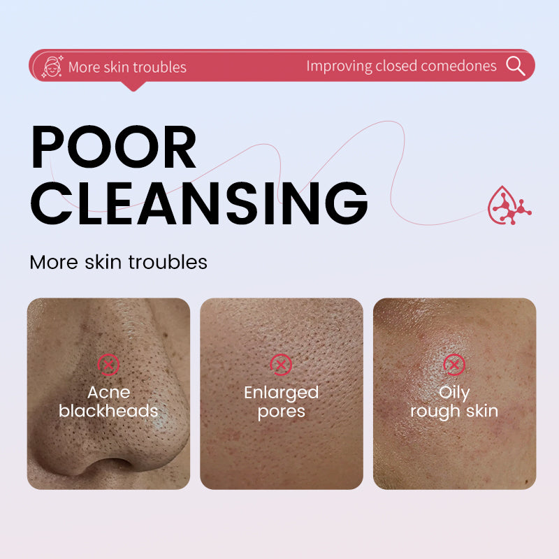 HUNMUI Volcanic Mud Cleansing Mud Mask Stick 40g Tri Light Beauty
