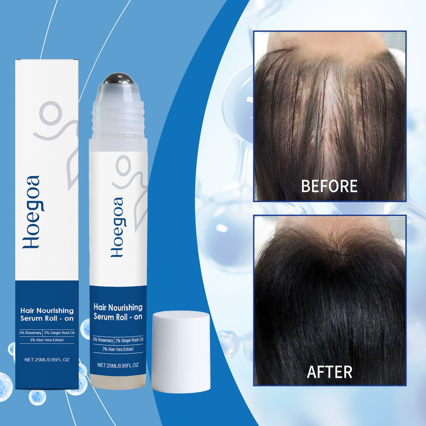 Hair Growth Roll-On Tri Light Beauty