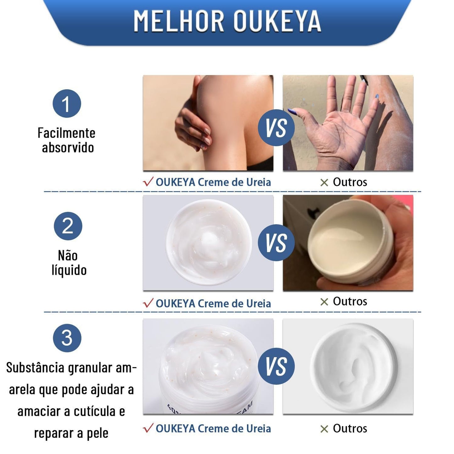 Urea Cream Moisturizing Hand And Foot Cream For Dryness Prevention Tri Light Beauty