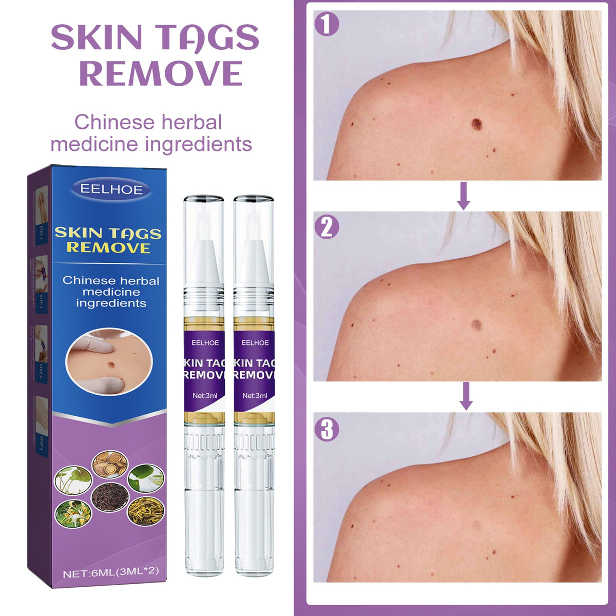 Skin Care Pen 3ml 1box Tri Light Beauty