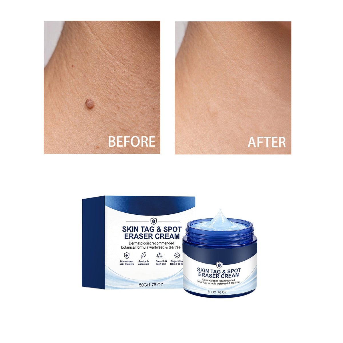 Skin Care Cream 30g 1box Tri Light Beauty