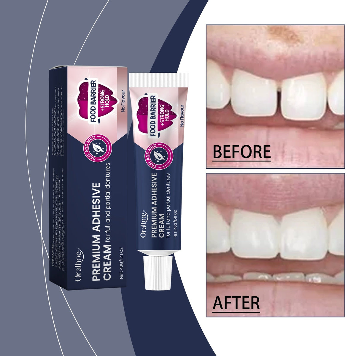 Dental Fixing Adhesive 40g-box Tri Light Beauty