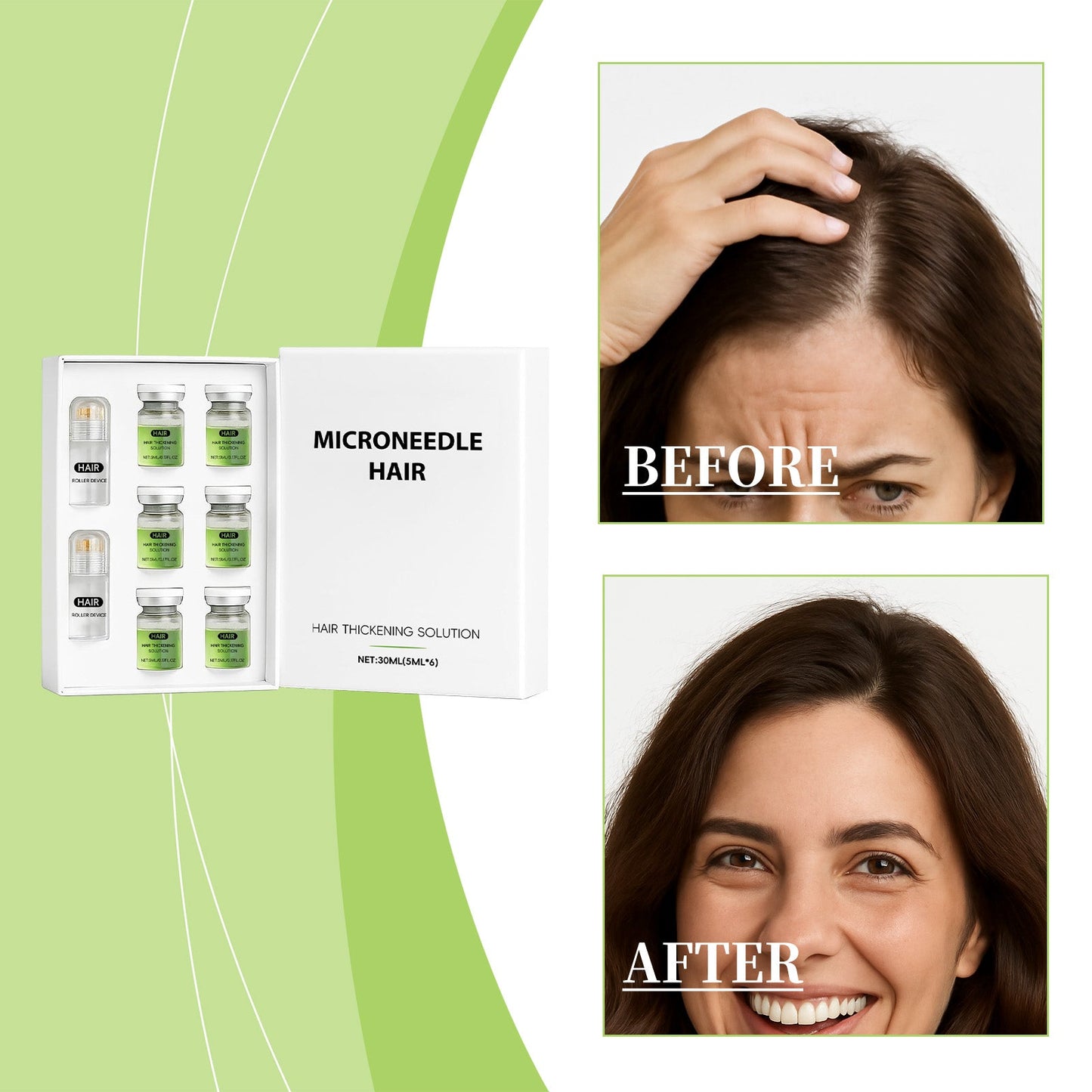 Dense Micro-Needle Roller Serum 5mlx6pcs Tri Light Beauty