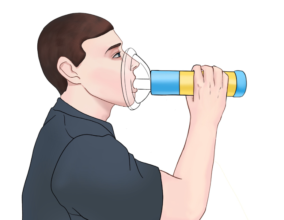 Choking Emergency Device Pi-Mart