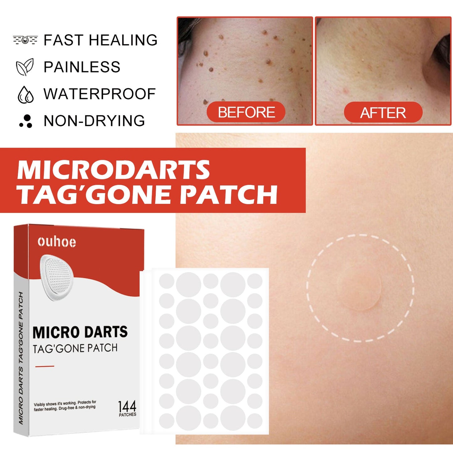 Purifying Face Patches 144PCS Tri Light Beauty