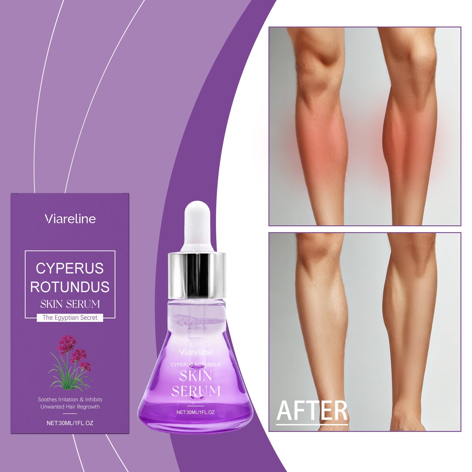 Post-hair Removal Repair Serum 30ml Tri Light Beauty