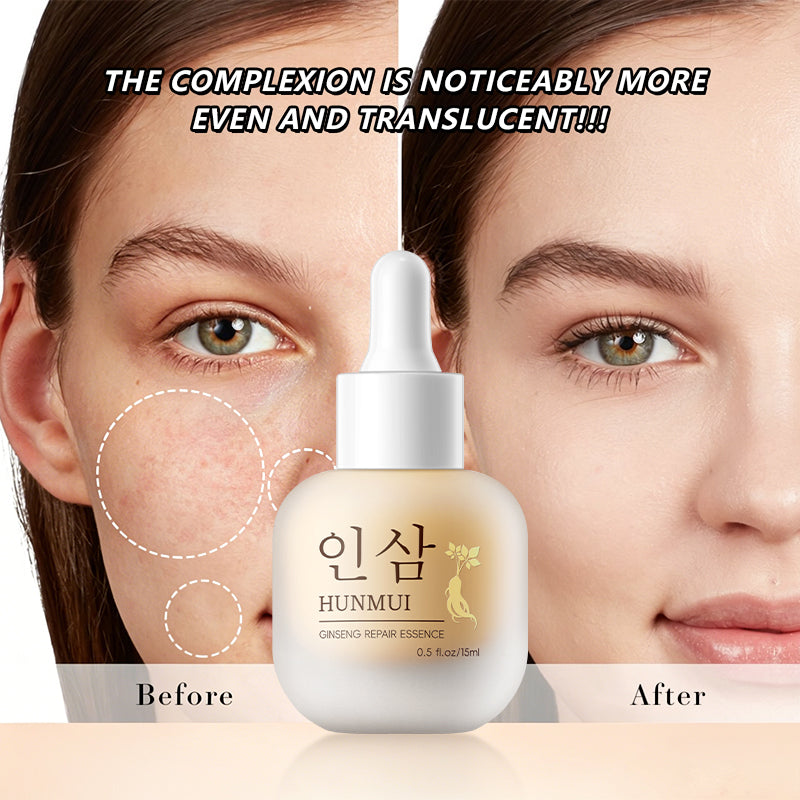 HUNMUI Ginseng Repair 15ml Tri Light Beauty