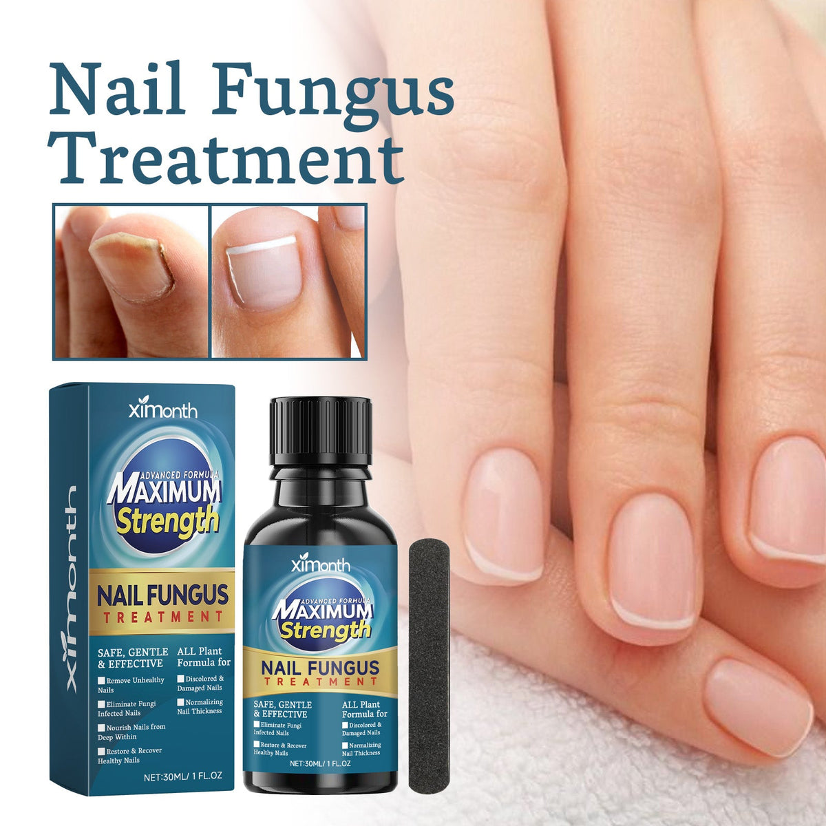 Nail Embedding Thickened Bright Nail Grey Nail Soft Nail Hand Foot Nail Care Liquid Nail Care Liquid 30 Bottles-1 Scraper Box Tri Light Beauty
