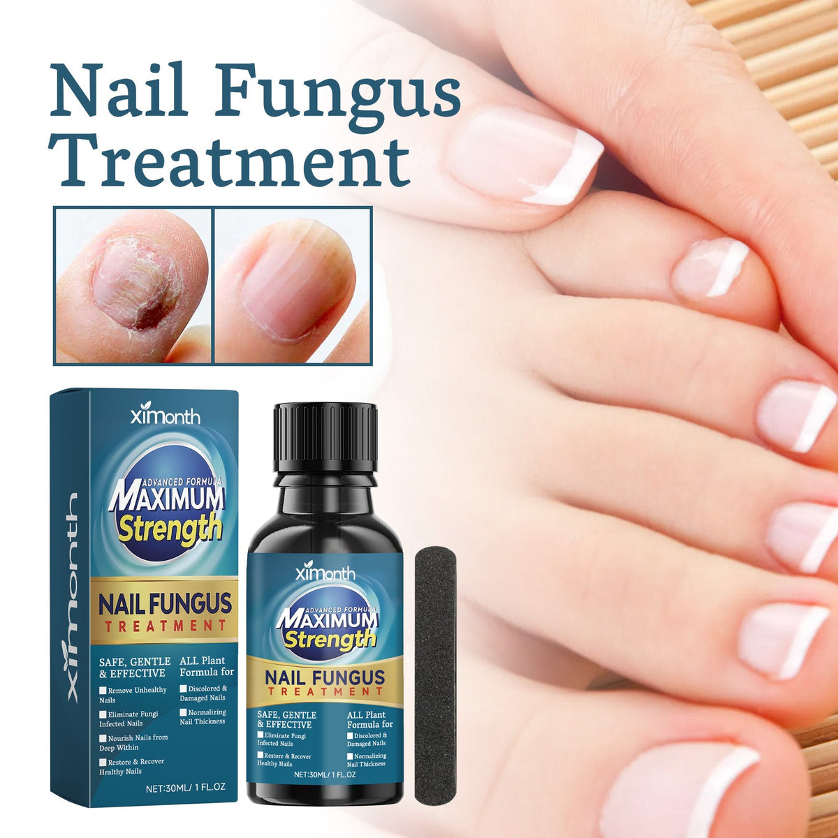 Nail Embedding Thickened Bright Nail Grey Nail Soft Nail Hand Foot Nail Care Liquid Nail Care Liquid 30 Bottles-1 Scraper Box Tri Light Beauty
