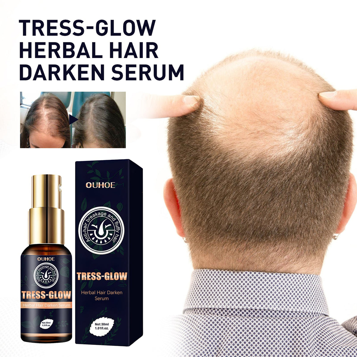 Gentle Moisturizing Scalp, Gentle Massage, Care For Beard, Gloss Care, E Ssence, Herbal Strong Hair Root E Ssence Oil, 30ml, 1 Box Tri Light Beauty
