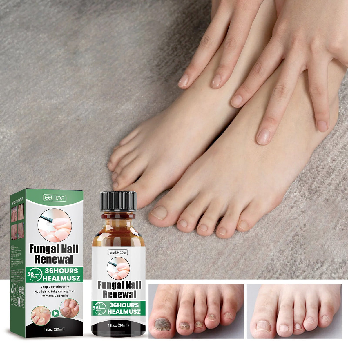 Bright Armor Soft Nail Moisturizing Armor Hand And Foot Nail Care Liquid Nail Strengthening Nourishing Liquid 30ml 1 Box Tri Light Beauty