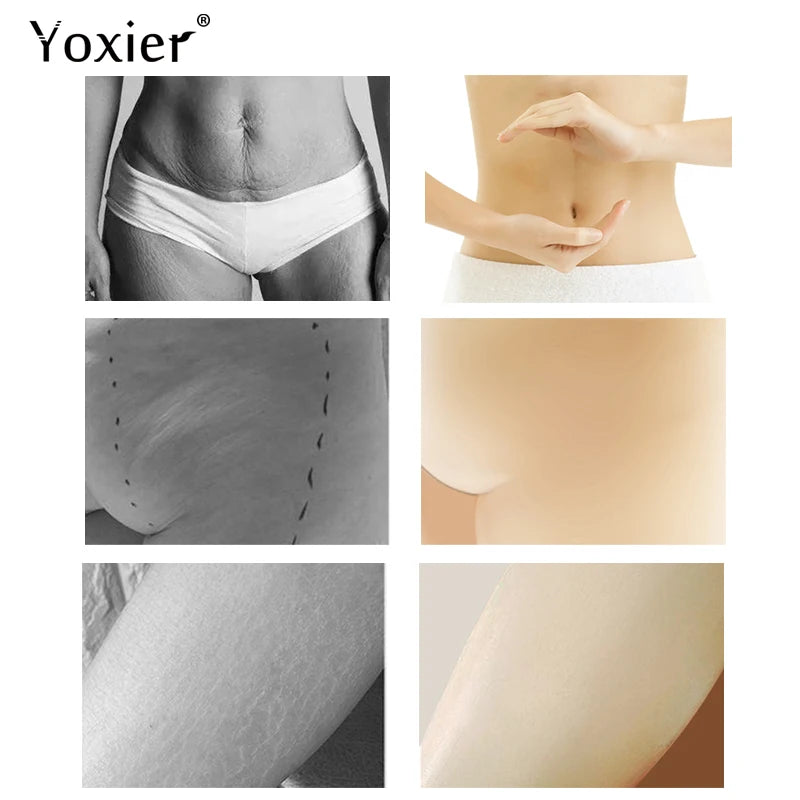 Yoxier Pearl Firming Body Lotion Slimming Cellulite Massage Remove Stretch Marks Cream Treatment Body Skin Care Health Lift Tool Pi-Mart