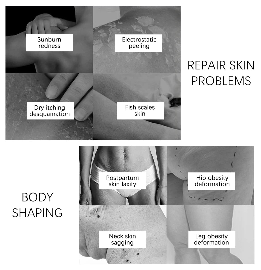 Yoxier Pearl Firming Body Lotion Slimming Cellulite Massage Remove Stretch Marks Cream Treatment Body Skin Care Health Lift Tool Pi-Mart