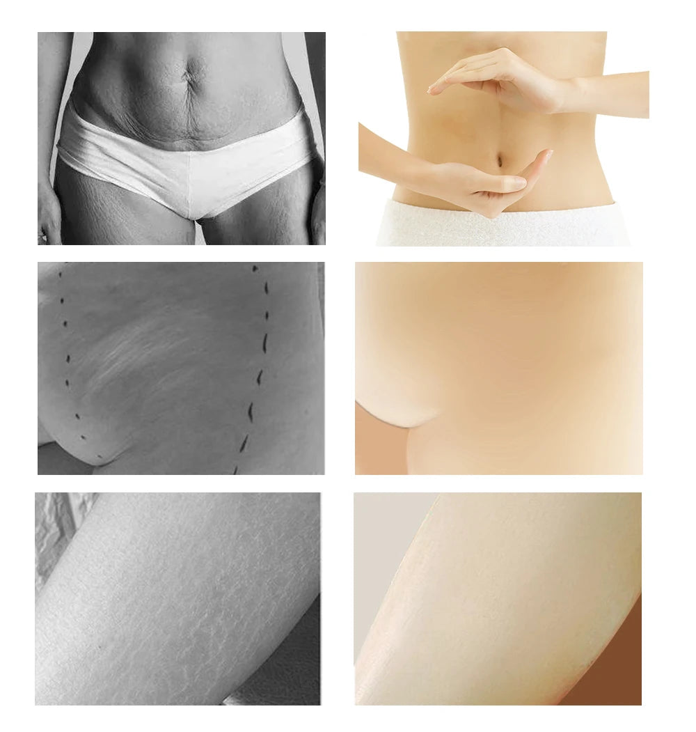 Yoxier Pearl Firming Body Lotion Slimming Cellulite Massage Remove Stretch Marks Cream Treatment Body Skin Care Health Lift Tool Pi-Mart