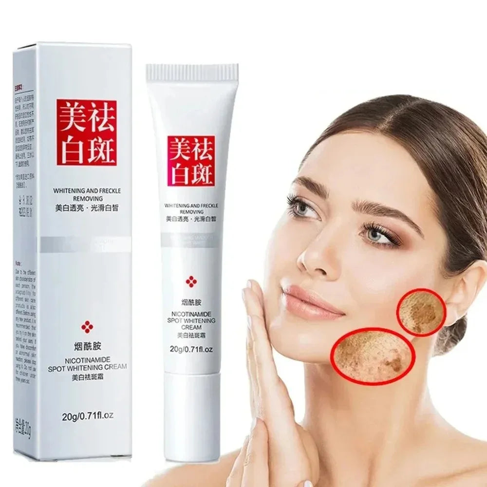 1/3/5pcs Fades Freckle Dark Spots Face Cream Niacinamide Whitening Cream Vitamin E Improve Dullness Fast Brighten Nourish Skin Pi-Mart