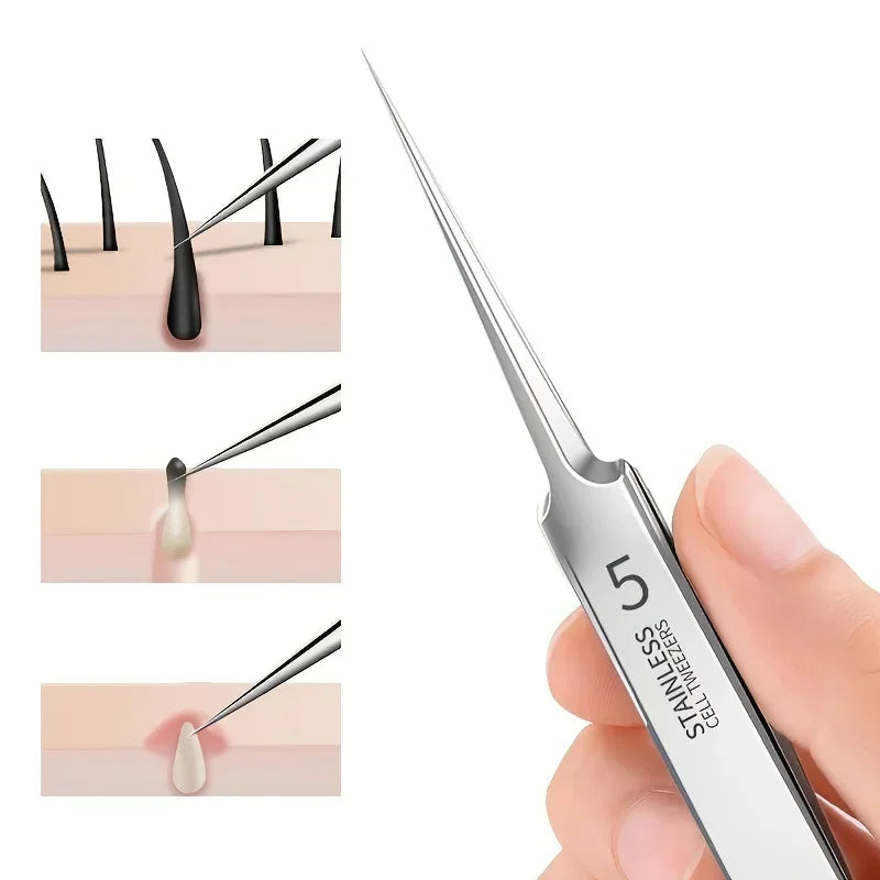 German 1/3/8Pack Extra Fine No. 5 Cellular Acne Blackhead Tweezers - Facial Beauty Remove Acne Needle Tools for Skin Care Tools Pi-Mart