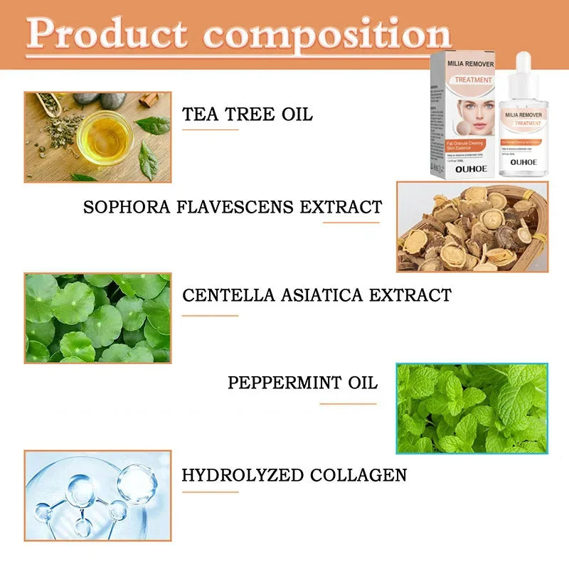 Fat Granules Removal Eye Serum Eye Milia Repair Treatment Products Wrinkle Lifting Moisturizing Anti-Puffiness Korean Skin Care Pi-Mart