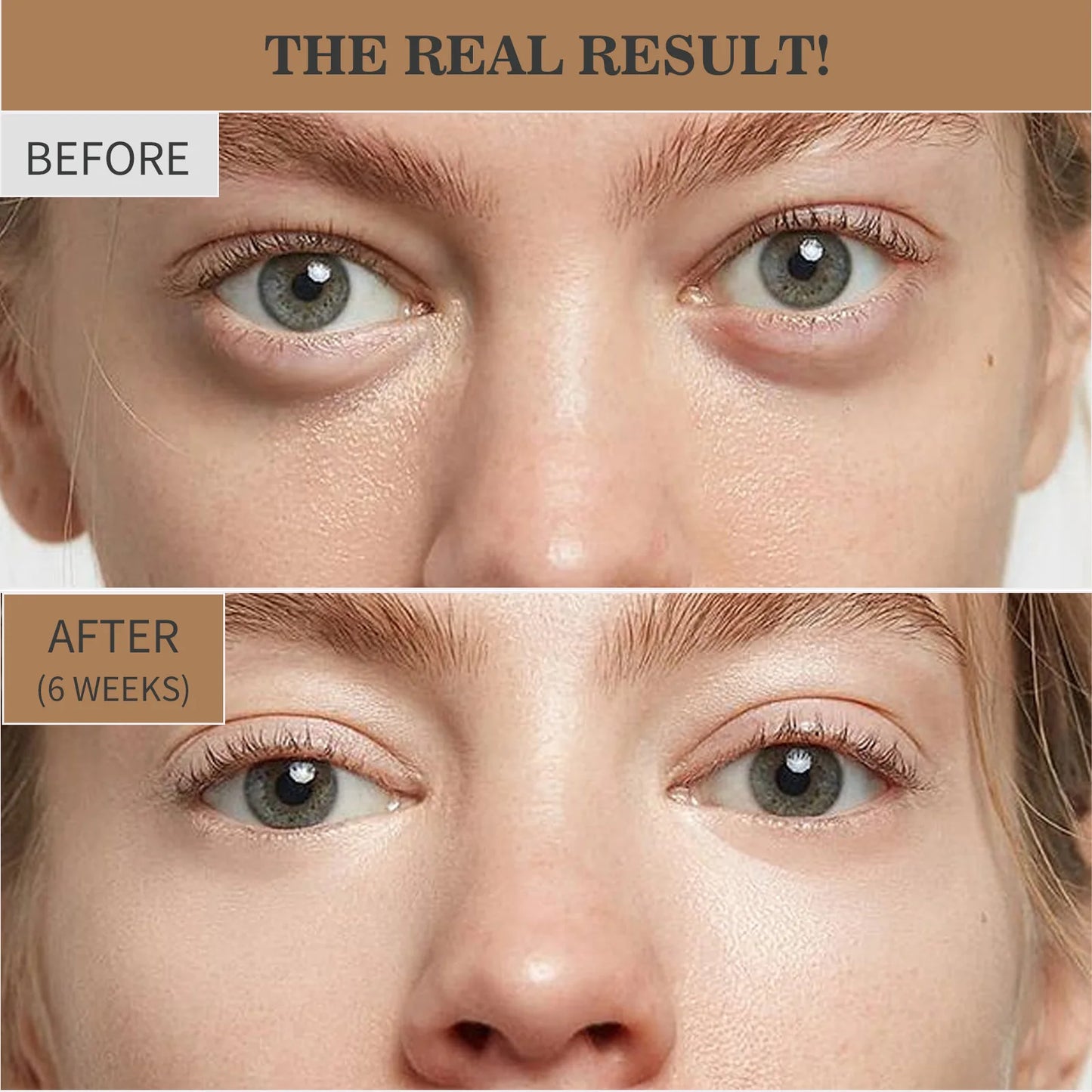 Retinol Eye Cream Anti Wrinkles,Anti Puffiness Remove Dark Circle Eye Bag Hyaluronic Acid Moisturize Peptides Soothe Skin Care Pi-Mart