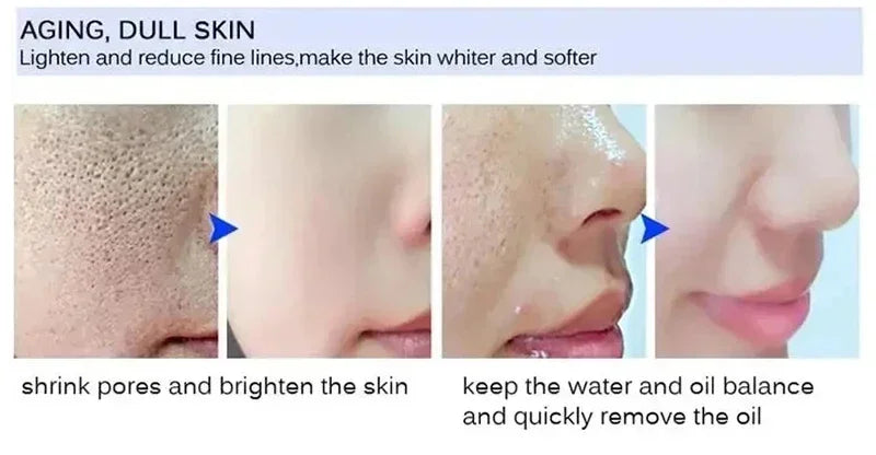 Remove Large Pores Serum Salicylic Acid Facial Pore Shrinking Tightening Pore Minimizing Firming Smooth Essence Korean Skin Care Pi-Mart
