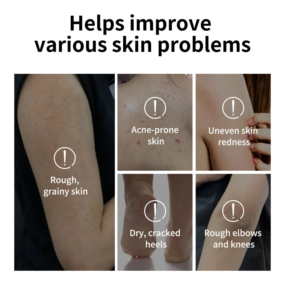 Glycolic Acid Exfoliating Body Stick Multiple Concerns Delivers Deep Effective Exfoliation Nourishing Moisture Deep Hydration Pi-Mart