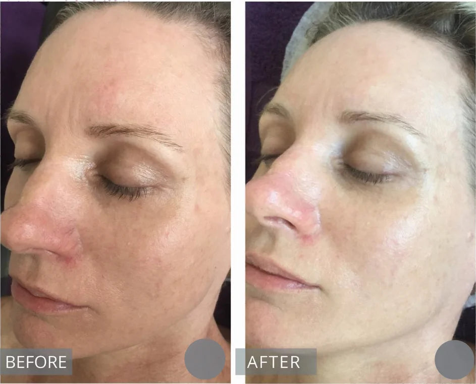 Centella Serum Nourish Improvement Dry Skin Smoothing Tightening Brightening Moisturizing Hyaluronic Acid Face Essence Skin Care Pi-Mart