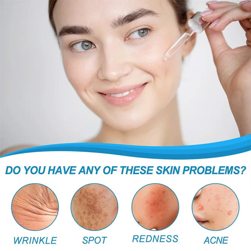 1/3/5pcs B5 Shrink Pores Serum Pure Hyaluronic Acid Lifting Firming Fine Lines Reduce Lightening Dark Circle 30ML Hyalu Essence Pi-Mart