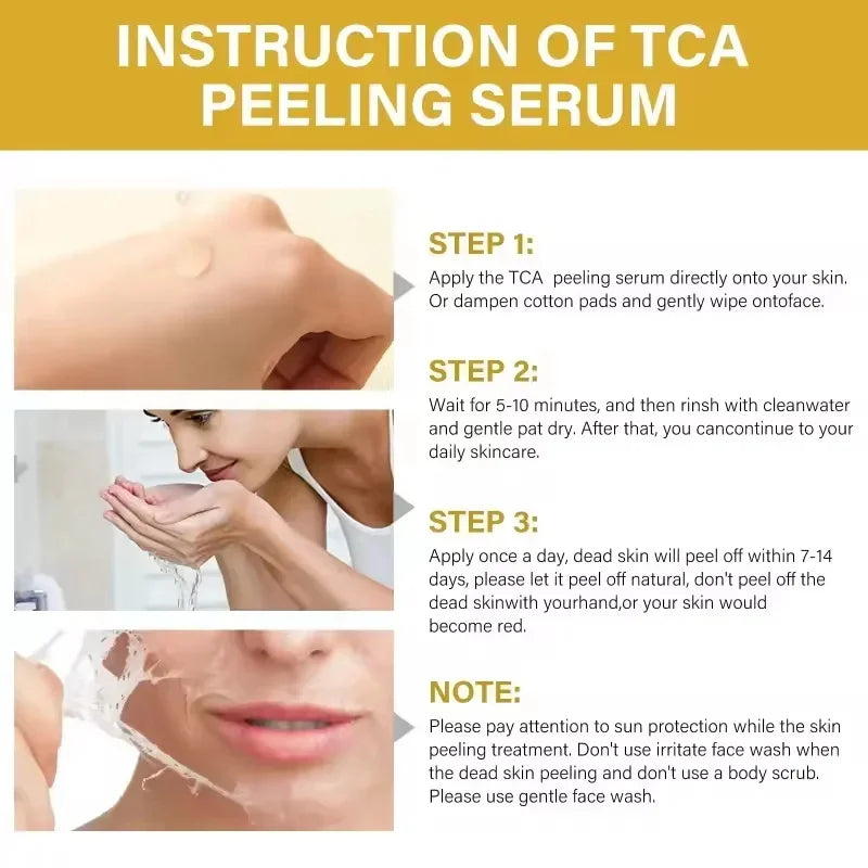 Acid Peeling Serum Chemical Exfoliant Peel For Remove Face Dark Skin Spots Whiten Lighten Melanin Peeling Solution Skin Peel Pi-Mart