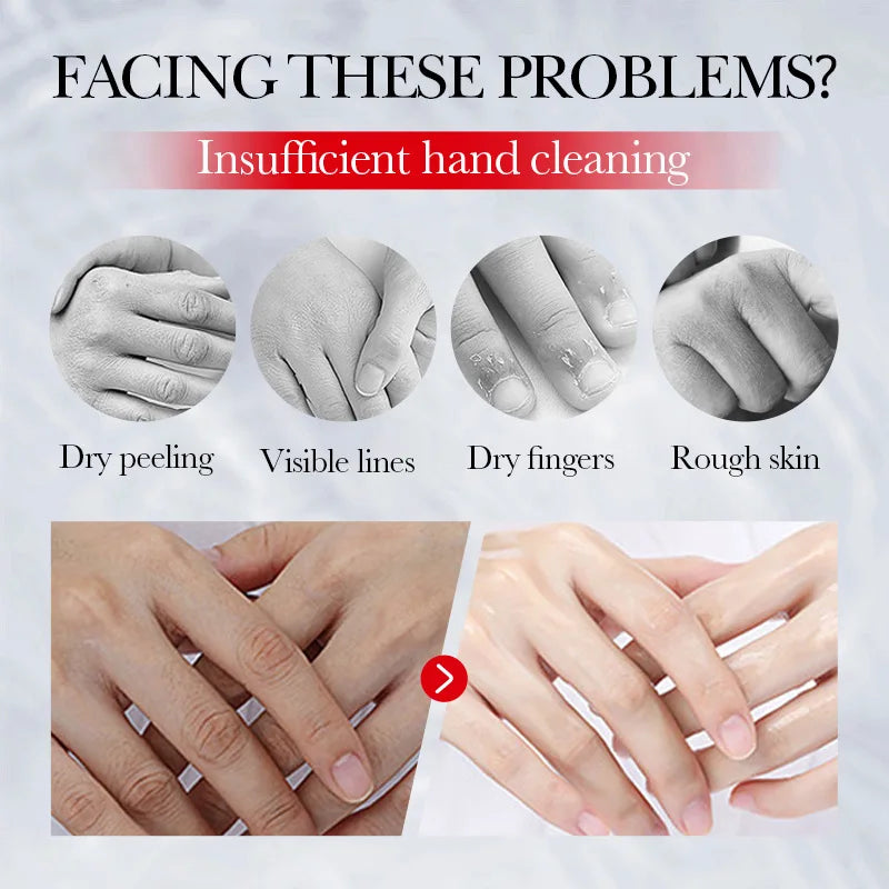 SADOER Kojic Acid Hand Cream Moisturizing Nourishing Brightening Hydrating Hand Creams Beauty Hands Skin Care Products Tri Light Beauty