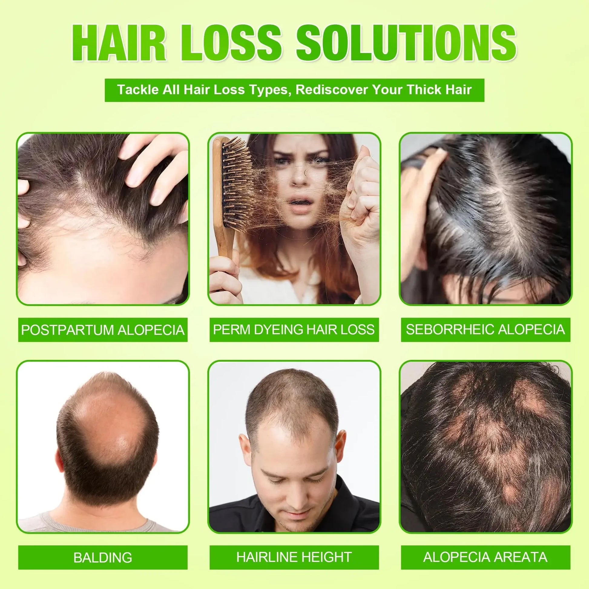 Anti-Hair Loss Scalp Care Roller Serum Kit Nourishes Roots Strengthens Hair Prevents Baldness Daily Care Pi-Mart